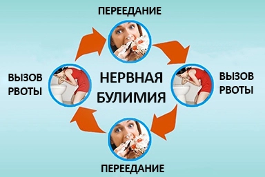 Лечение булимии в Ульяновке